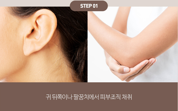 피부의 근본적인 재생을 돕는 자가성장인자와 100% 순수 콜라겐의 결합의 시너지 작용 