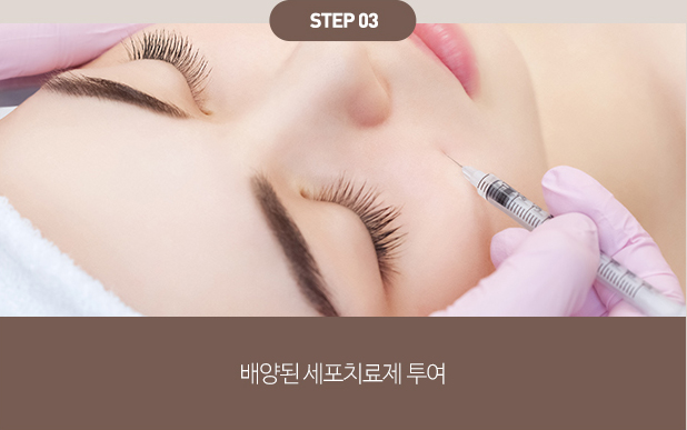 피부의 근본적인 재생을 돕는 자가성장인자와 100% 순수 콜라겐의 결합의 시너지 작용 